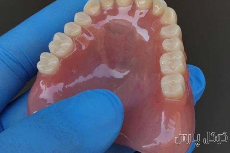 ساخت دندان مصنوعی با ضمانت | دندانسازی در کرج