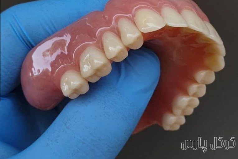 ساخت دندان مصنوعی با ضمانت | دندانسازی در کرج