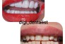 دیجی دنتالیست | ایمپلنت دندان سعادت آباد