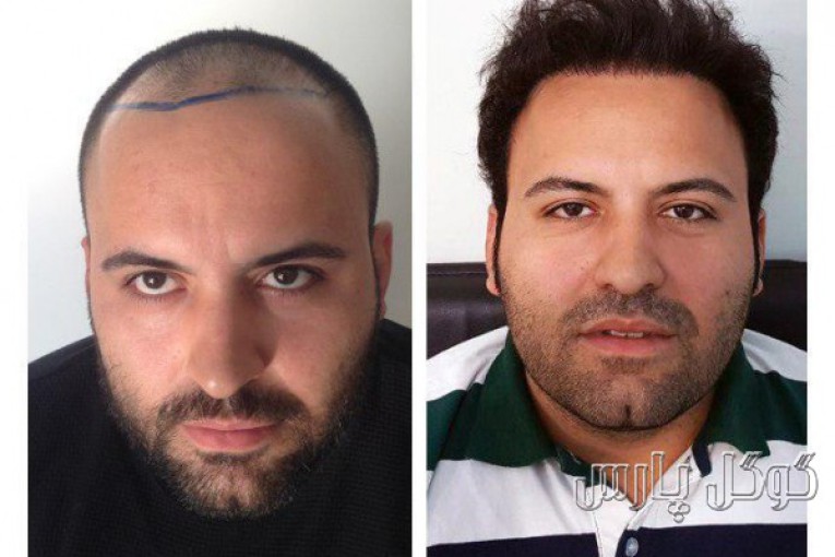 دکتر محمد حسین جلالی جراح پلاستیک بینی و صورت