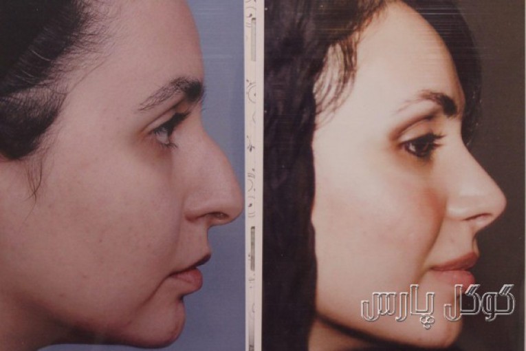 دکتر محمد حسین جلالی جراح پلاستیک بینی و صورت