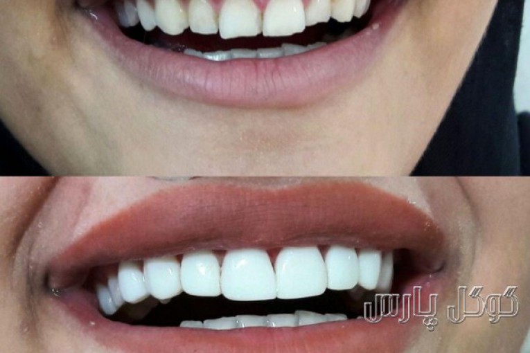 دندانپزشکی خط لبخند