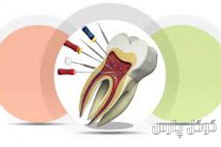  متخصص درمان ریشه دندان