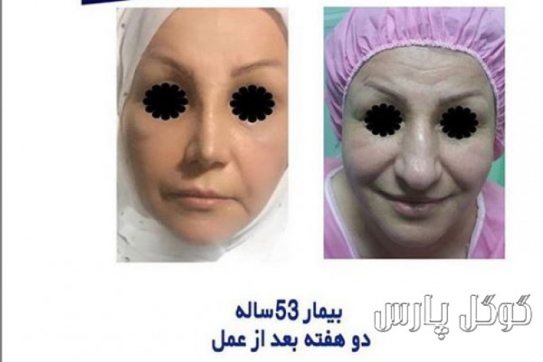 دکتر علی بخشنده فرد متخصص جراحی فک و صورت