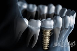 جراح دندانپزشک و ایمپلنتولوژیست دکتر رحیم فرهمند