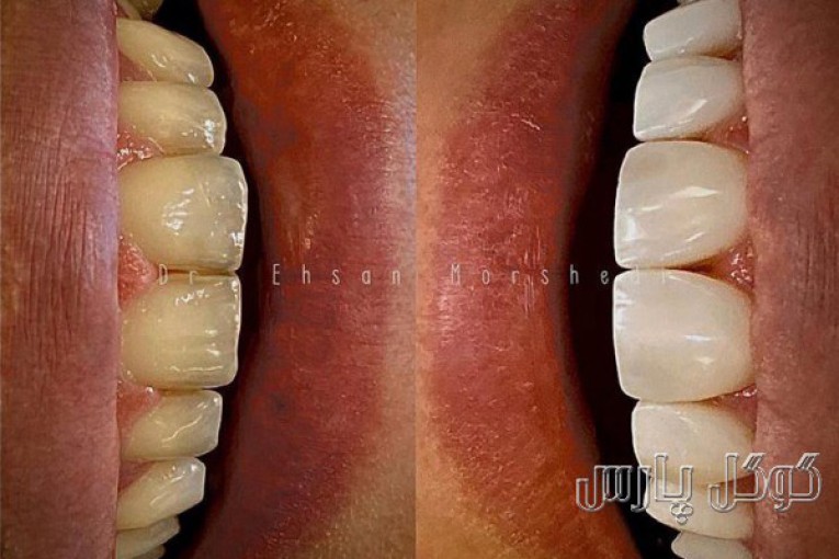 متخصص پروتزهای دندانی و زیبایی