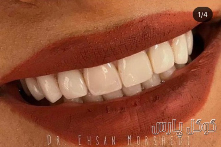 متخصص پروتزهای دندانی و زیبایی