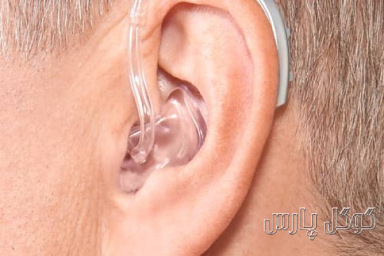 مرکز ارزیابی شنوایی و سمعک نجوا 
