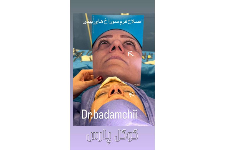 مطب جراحی پلاستیک بینی دکتر بهرام بادامچی