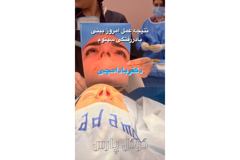 مطب جراحی پلاستیک بینی دکتر بهرام بادامچی