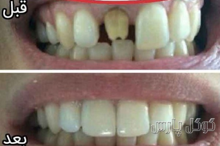 مطب دندانپزشکی دکتر بهروز فرجی