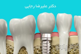 دندانپزشکی دکتر رجایی 09203011928 