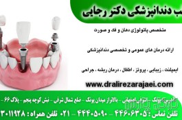 مطب دندانپزشکی دکتر رجایی | جراحی دندان محدوده پونک