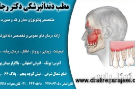 دندانپزشکی دکتر رجایی | ایمپلنت دندان غرب تهران