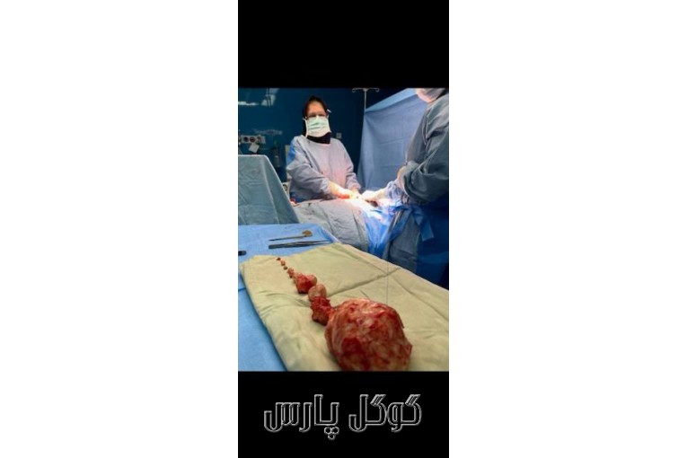 پروفسور فریبا الماسی | بهترین جراح لاپاروسکوپی
