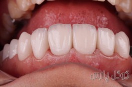 لابراتوار دندانسازی و پروتزهای دندانی پورصالحی 
