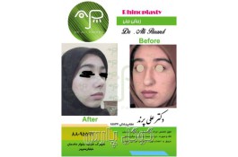 دکتر علی پرند |  فوق تخصص جراحی زیبایی و ترمیمی