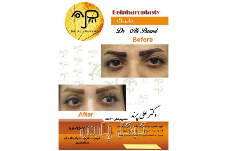 دکتر علی پرند |  فوق تخصص جراحی زیبایی و ترمیمی