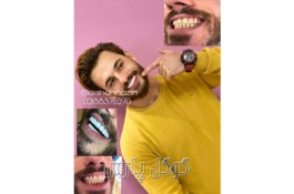 کلینیک دندانپزشکی دکتر حسین شهنازیان 02188376270 | ترمیمی و زیبایی دندان