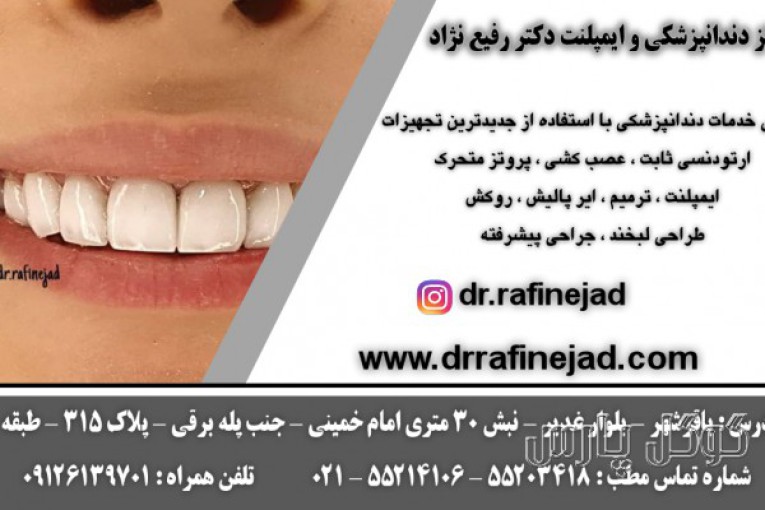 مرکز دندانپزشکی و ایمپلنت دکتر رفیع نژاد | دندانپزشکی باقرشهر